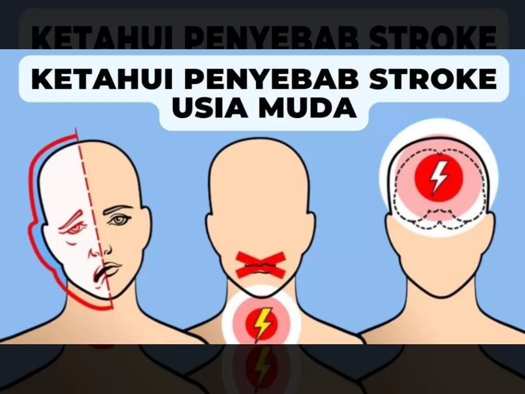 Stroke Mengancam Usia Muda? Kisah Delia yang Alami Stroke di Usia 20 Tahun Jadi Peringatan